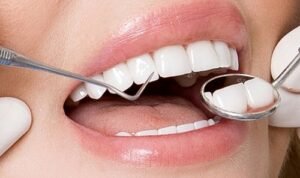 Phân Biệt Răng Sứ Thẩm Mỹ Tốt Từ Các Tiêu Chí Quan Trọng